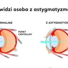 Jakie są wady wzroku? Poznaj objawy i skuteczne leczenie