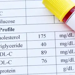 Wynik lipidogramu: cholesterol całkowity 175 mg/dL, HDL 89 mg/dL, LDL 76 mg/dL. Wartość cholesterolu nie-HDL jest podwyższona.