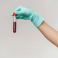 Ręka w rękawiczce trzyma probówkę z krwią. Wyniki badań, w tym rdw-cv, pomogą ocenić stan zdrowia.