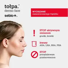 Cera trądzikowa: Jaki peeling wybrać? Kwasy, enzymy i czego unikać
