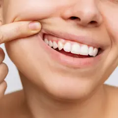 Dito con un dito, un sorriso mostra denti bianchi e **gengive normali**, segno di buona salute orale.