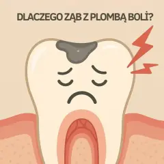 Smutny ząb z plombą i czerwonymi błyskawicami bólu. Dlaczego ząb z plombą boli?