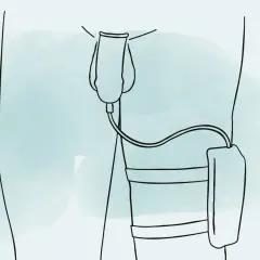 Illustration zeigt, wie man ein Urinalkondom anlegt. Ein Schlauch verbindet das Kondom mit einem Auffangbeutel am Bein.