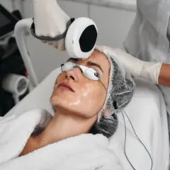 Trattamento estetico per come rimpolpare il viso con laser. Una persona con occhiali protettivi riceve un trattamento sul viso.
