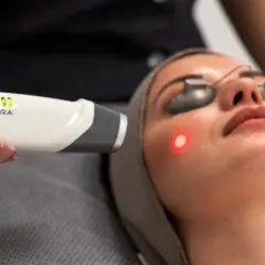 En kvinna får en behandling med laser genesis. En hand håller en laserapparat nära hennes ansikte, där en röd prick syns på kinden.