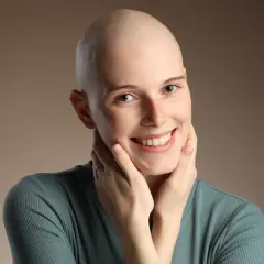 Lächelnde Frau mit Glatze, die ihre Wangen berührt. Ihre positiven Lymphom Chemotherapie Erfahrungen strahlen aus ihr.