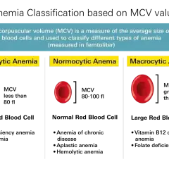 Porównanie wielkości krwinek czerwonych w mikrocytozie, normocytozie i makrocytozie. Badania na anemię oceniają te parametry.