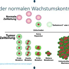 Verlust der normalen Wachstumskontrolle: Normale Zellen teilen sich, beschädigte Zellen sterben ab. Bei Tumor-Zellteilung, ohne Reparatur, kommt es zu c-Zell-Hyperplasie und unkontrolliertem Wachstum.