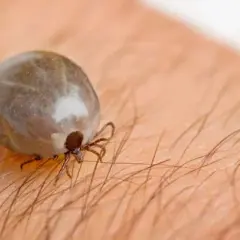 W którą stronę wykręcić kleszcza? Kluczowe wskazówki na pewno pomogą