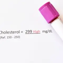 Wynik cholesterolu 299 mg/dL, co oznacza wysoki poziom. To może być sygnał, by przyjrzeć się diecie i rozważyć ezehron.