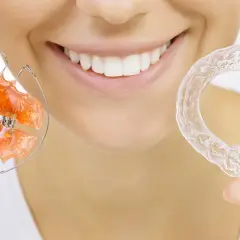Uśmiechnięta twarz z aparatem ortodontycznym i przezroczystymi nakładkami. Dr Smile oferuje rozwiązania dla pięknego uśmiechu.