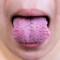 Lengua rosada con aspecto agrietado, como si tuviera una herida, sobresale de unos labios.