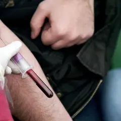Pobieranie krwi do badania. Lekarz w białej rękawiczce pobiera krew do probówki, sugerując, że **ALT AST podwyższone** może być przyczyną.