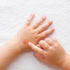 Skuteczne sposoby na kleszcze dla niemowlaka - bezpieczne repelenty