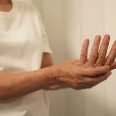 Dłoń z widocznym drętwieniem kciuka lewej ręki, palce lekko zgięte.