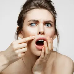 Bolesny pryszcz: Szybkie sposoby na ulgę i kiedy iść do dermatologa