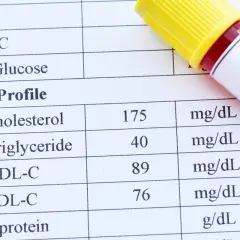 Lipidogram: Jaka kolacja? Co i kiedy zjeść, by wynik był pewny?