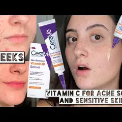 CeraVe Vitamin C Serum: Vorteile, Anwendung und echte Erfahrungen