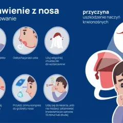 Krwawienie z nosa przyczyny: najczęstsze powody i co z nimi zrobić.