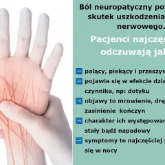 Dłoń z zaznaczonymi nerwami, ilustrująca ból neuropatyczny. Opisuje palący, piekący ból, mrowienie i drętwienie.