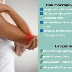 Dna moczanowa objawia się nagłym, ostrym bólem stawu, obrzękiem i zaczerwienieniem. Leczenie obejmuje wizytę u lekarza, dietę i zdrowy styl życia.