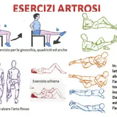 Esercizi per le ginocchia, quadriciti ed anche. Da seduto alzare l'arto flesso. Esercizi in decubito laterale e prono per estendere l'arto teso.