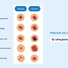 Ilustracja porównuje pieprzyk i czerniak, pokazując różnice w asymetrii, brzegach, kolorze, średnicy i ewolucji. Zwróć uwagę na czarną kropkę na sutku.