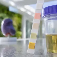 Test paskowy do badania moczu, obok pojemnika z żółtym płynem. Model nerki w tle. Wynik może wskazywać na białko w moczu.