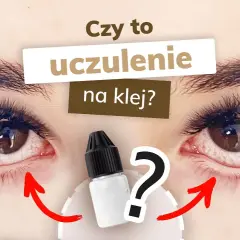 Alergia na klej do rzęs: Objawy, leczenie i co robić krok po kroku