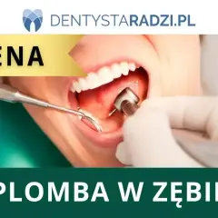 Dentysta zakłada plomba chemoutwardzalna. Widoczne narzędzia stomatologiczne i usta pacjenta.