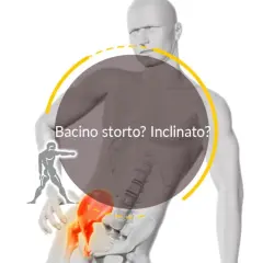 Un bacino ruotato o inclinato può causare dolore. L'osteopata può aiutarti a riallinearlo.