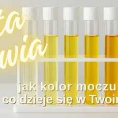 Paleta zdrowia: od jasnego do ciemnego moczu. Bardzo żółty mocz może sygnalizować zapalenie pęcherza.