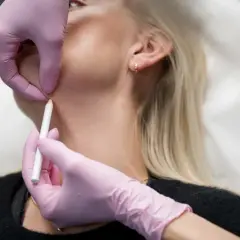 En person får botox i nacken. En hand med rosa handske markerar med en penna på huden.