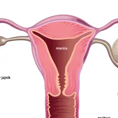Anatomia kobieca: macica, jajowody, jajnik prawidłowy i jajnik z torbielą.