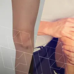 Anatomia kolana z widoczną rzepką i bólem odczuwanym przez osobę trzymającą się za kolano.