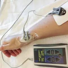 Ramię pacjenta podłączone do urządzenia do jonoforezy. Elektrody i panel sterowania z widocznymi parametrami.