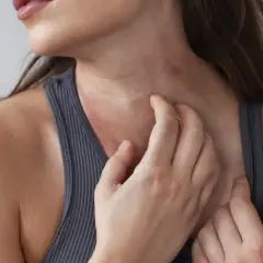 Una mujer se rasca el cuello, mostrando un sarpullido rojo e irritado.
