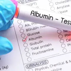 Rękawiczka w niebieskiej rękawiczce trzyma probówkę z napisem "Albumin - Test". Na formularzu medycznym zaznaczono "Albumin", co sugeruje badanie poziomu albuminy.