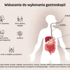 Objawy jak nudności, ból brzucha, wzdęcia, problemy z wypróżnianiem mogą sugerować potrzebę badania. Gastroskopia to metoda diagnostyczna co zamiast gastroskopii?