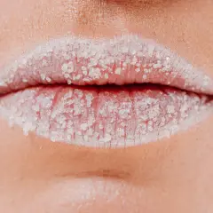 Labios blancos cubiertos de azúcar, posibles causas de sequedad y descamación.