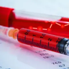 Hämophilie Diagnostik: Wichtige Schritte und Symptome, die Sie kennen sollten