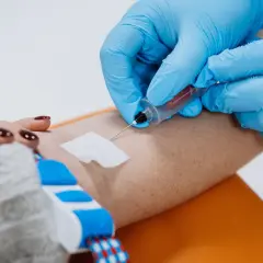 Cholesterol czy na czczo? Sprawdź, co mówią nowe wytyczne