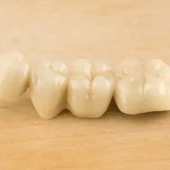 Puente dental de porcelana sobre fondo de madera. Podría causar dolor en puente dental al masticar si no está bien ajustado.