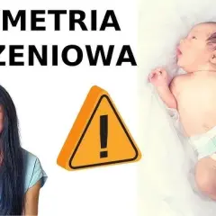 Ile trwa rehabilitacja asymetrii u niemowlaka i co wpływa na czas?