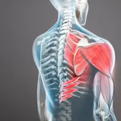 Vue anatomique du dos humain, mettant en évidence le muscle trapèze supérieur rouge vif et les muscles environnants.