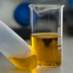 Jak przechowywać mocz przed oddaniem do laboratorium, by uniknąć błędów?