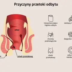 Ilustracja przedstawia anatomię odbytu z widoczną przetoką odbytu, wskazując na jej przyczyny, takie jak choroby proktologiczne czy zaburzenia metabolizmu.