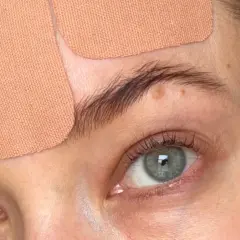 Närbild på ögon och panna med tejpremsor för face taping.