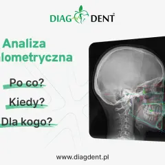 Analiza cefalometryczna: zdjęcie RTG czaszki z naniesionymi liniami i punktami pomiarowymi. Pytania: Po co? Kiedy? Dla kogo?