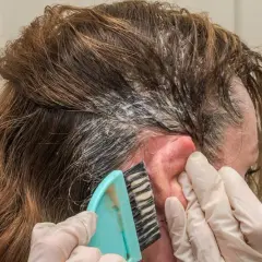 Manos enguantadas usan un cepillo para aplicar tinte en el cabello. Si te manchas la piel, aquí te explicamos como quitar el tinte de la piel.